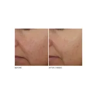 Advanced Retinol Plus Ferulic Overnight Treatment