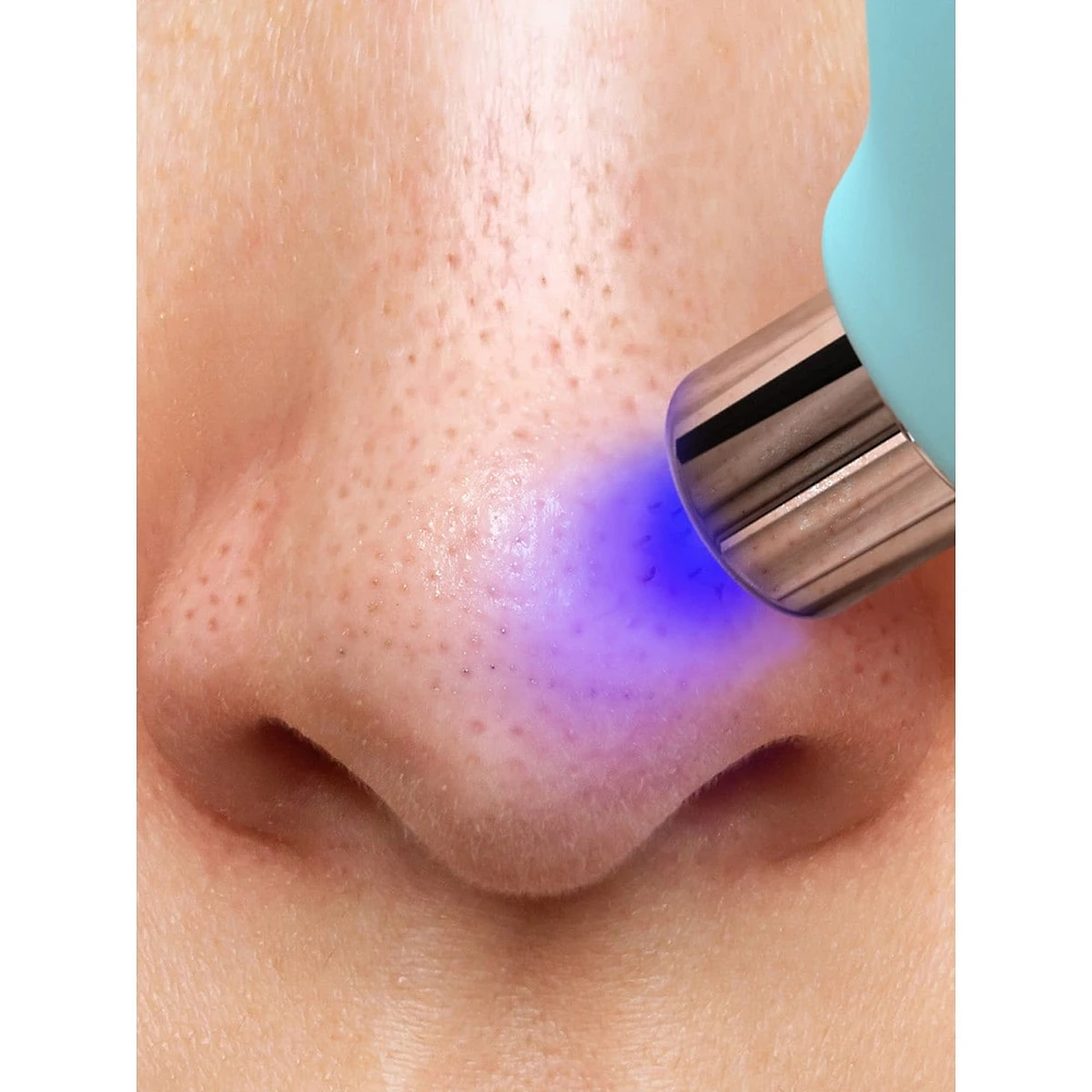 KIWI™ Blackhead Remover Pore Vacuum Device