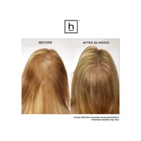 Appareil de croissance capillaire HairMax Laserband 82 ComfortFlex
