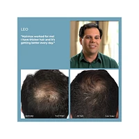 LaserBand 41 Hair Loss Device for Hair Growth