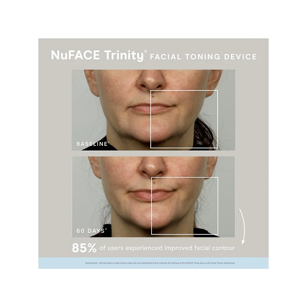 Trinity Facial Toning Device
