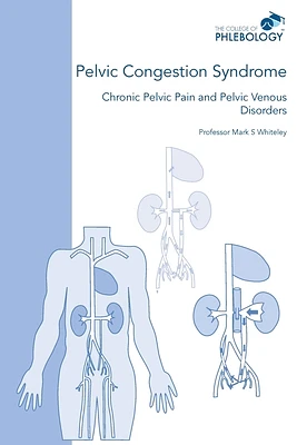 Pelvic Congestion Syndrome - Chronic Pelvic Pain and Pelvic Venous Disorders (Paperback)