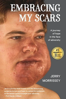 Embracing My Scars: A journey of hope in the face of adversity (Paperback)