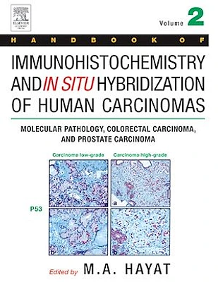 Handbook of Immunohistochemistry and in Situ Hybridization of Human Carcinomas