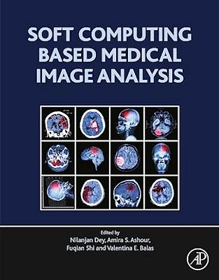 Soft Computing Based Medical Image Analysis