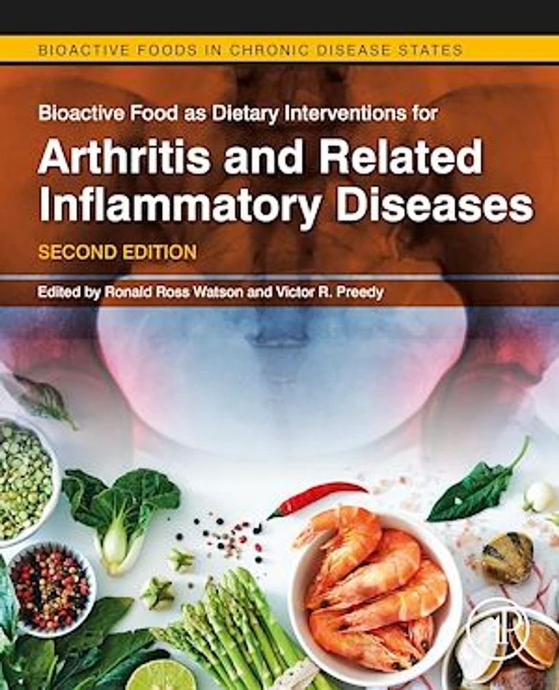 Bioactive Food as Dietary Interventions for Arthritis and Related Inflammatory Diseases