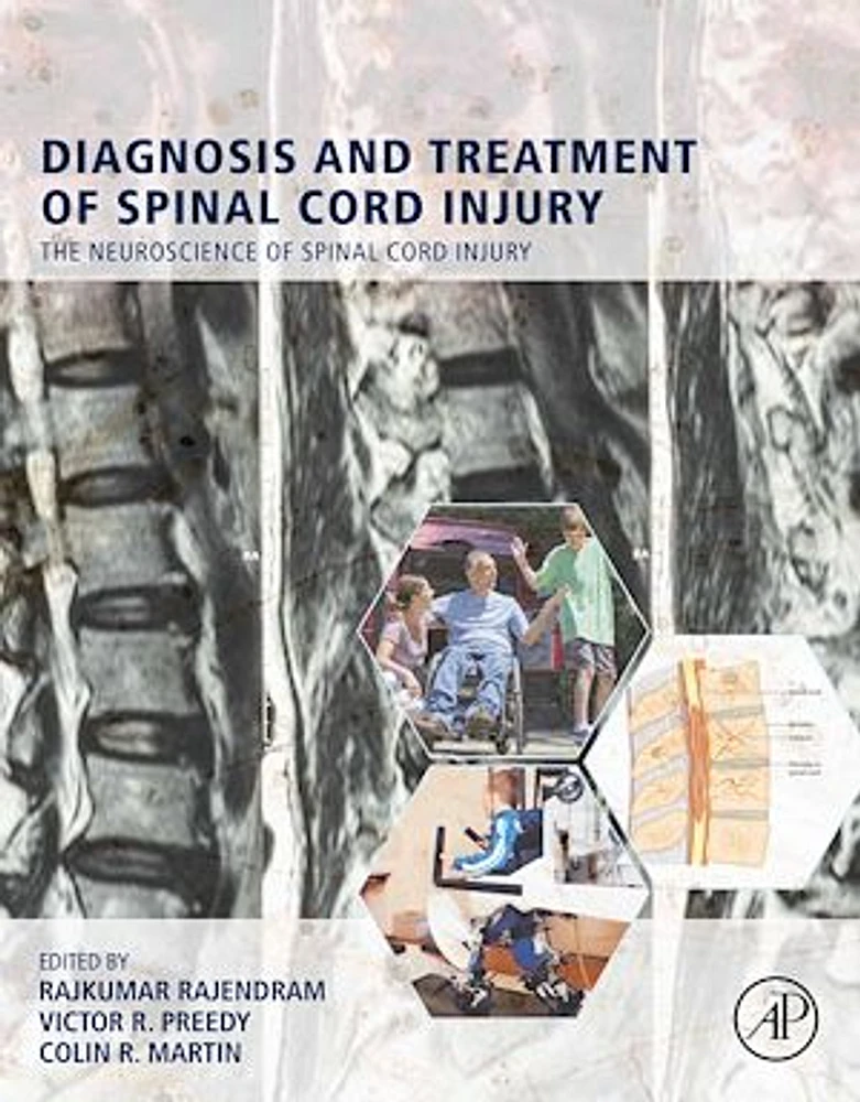 Diagnosis and Treatment of Spinal Cord Injury