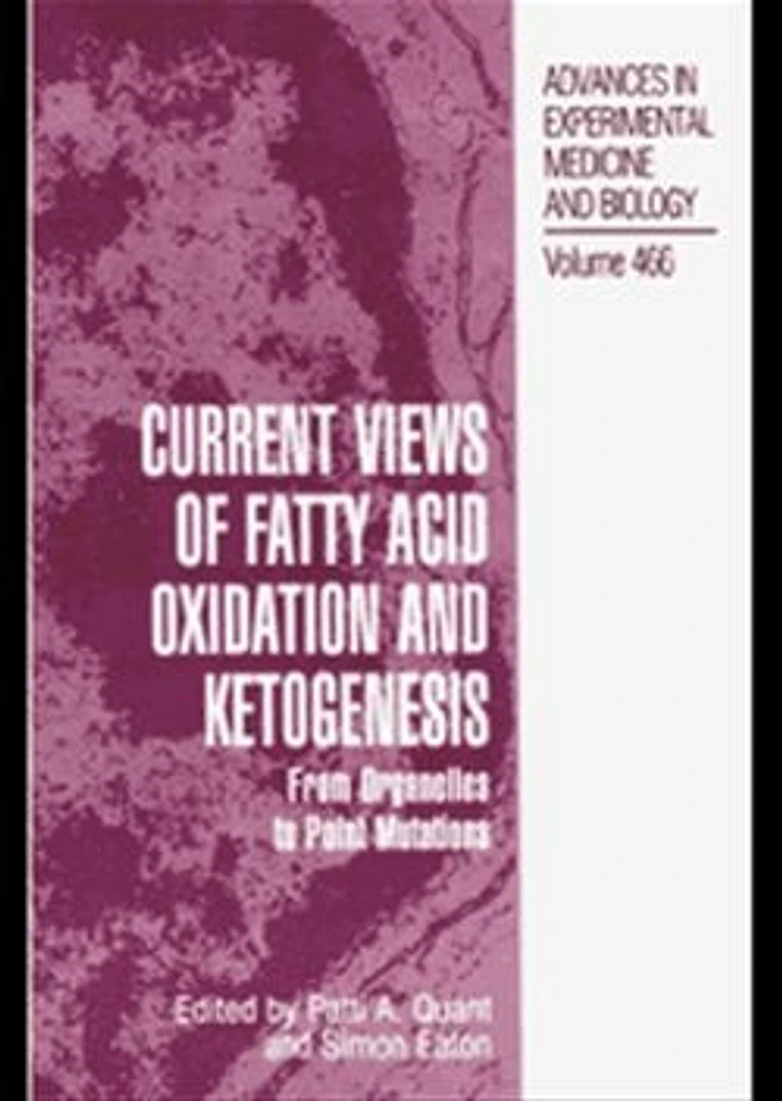 Current Views of Fatty Acid Oxidation and Ketogenesis From Organelles to Point Mutations