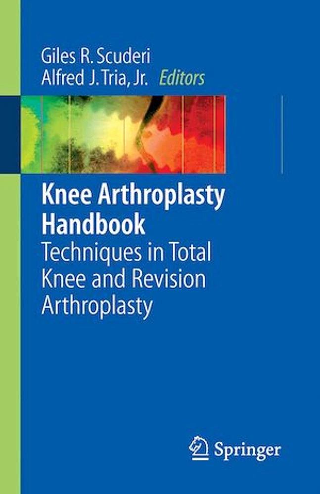 Knee Arthroplasty Handbook