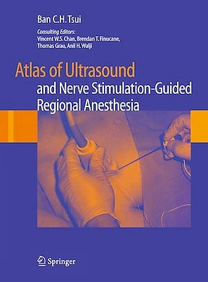 Atlas of Ultrasound- and Nerve Stimulation-Guided Regional Anesthesia