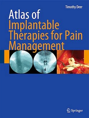 Atlas of Implantable Therapies for Pain Management