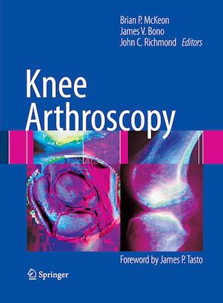 Knee Arthroscopy