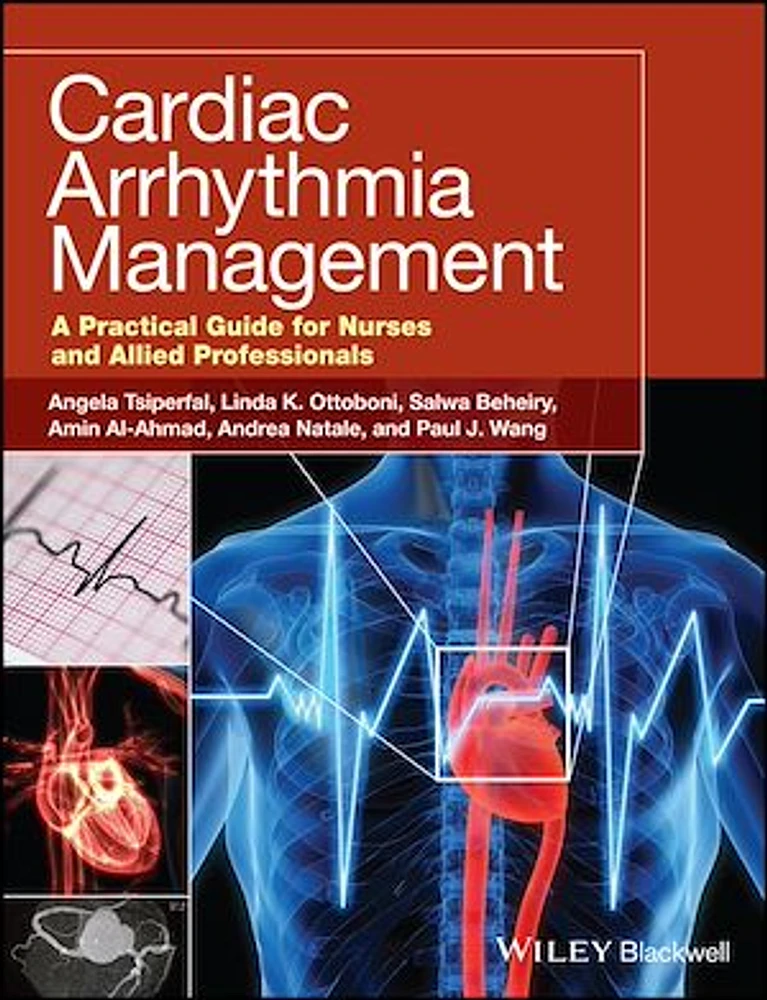 Cardiac Arrhythmia Management