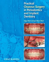 Practical Osseous Surgery in Periodontics and Implant Dentistry