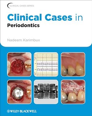 Clinical Cases in Periodontics