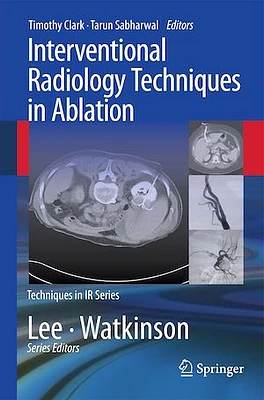 Interventional Radiology Techniques in Ablation