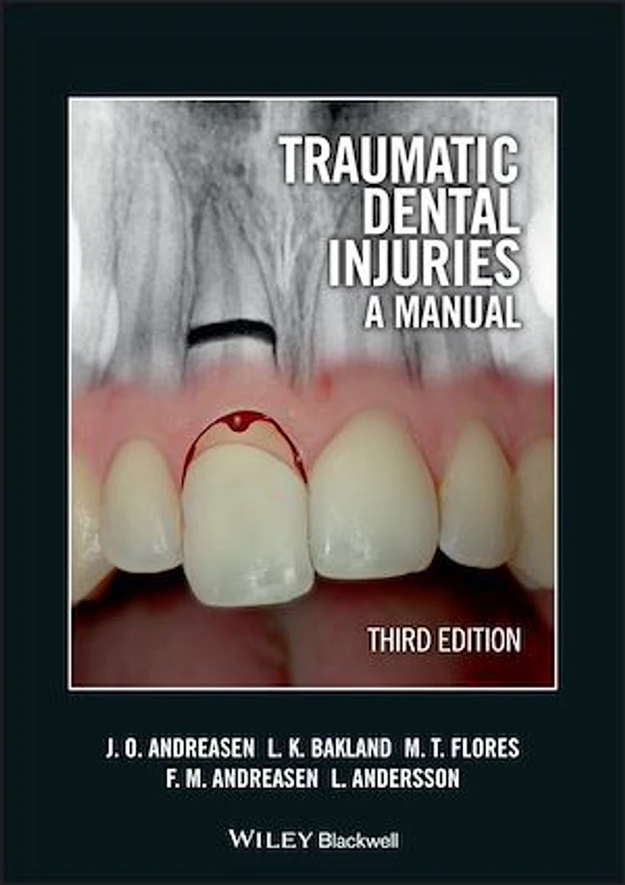 Traumatic Dental Injuries