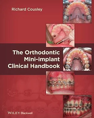 The Orthodontic Mini-implant Clinical Handbook