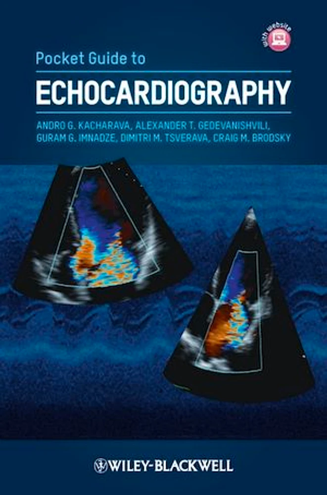 Pocket Guide to Echocardiography