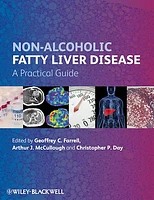 Non-Alcoholic Fatty Liver Disease