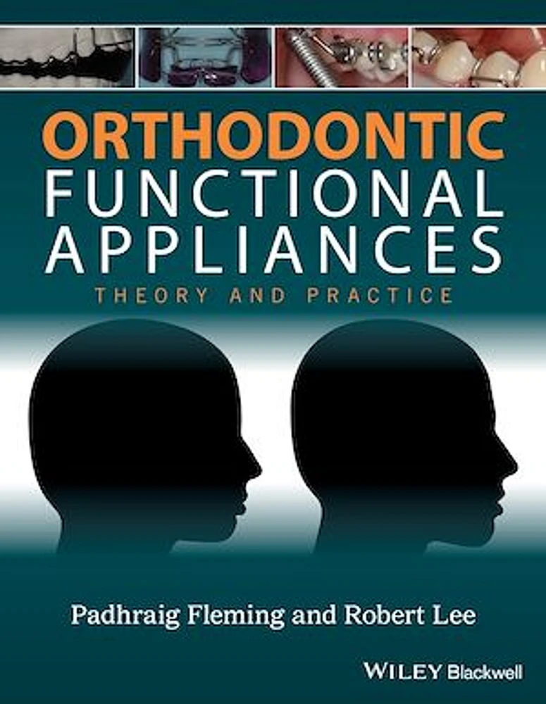 Orthodontic Functional Appliances