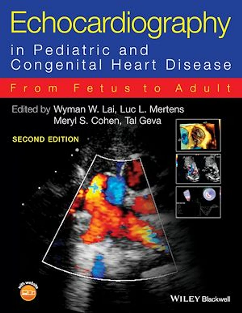 Echocardiography in Pediatric and Congenital Heart Disease