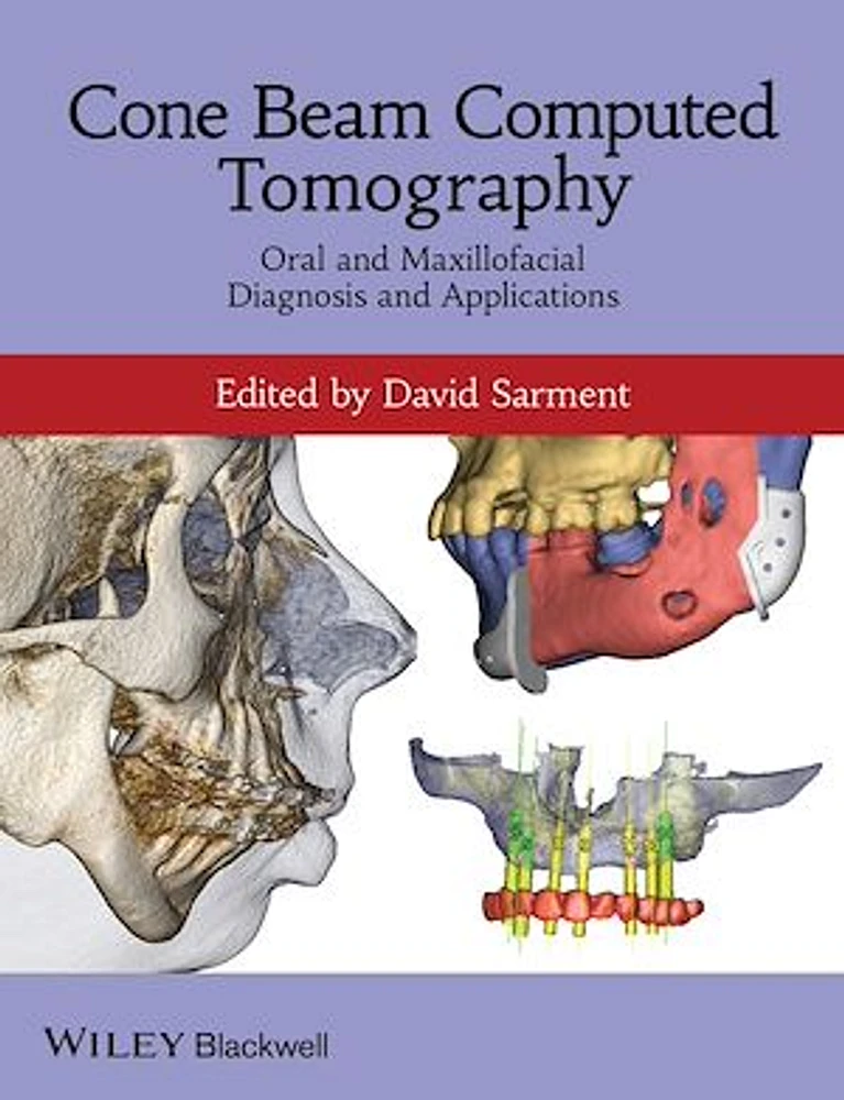 Cone Beam Computed Tomography