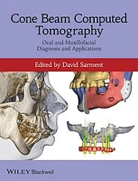 Cone Beam Computed Tomography