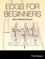 ECGs for Beginners