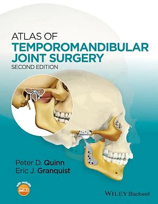 Atlas of Temporomandibular Joint Surgery