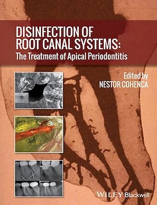 Disinfection of Root Canal Systems