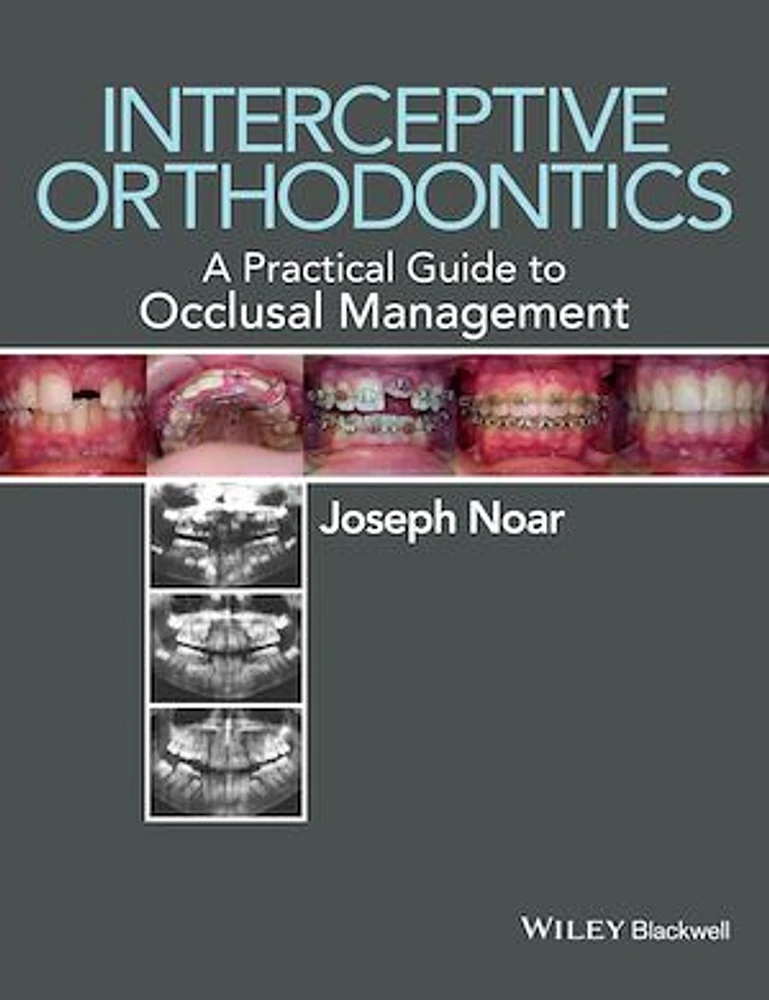 Interceptive Orthodontics