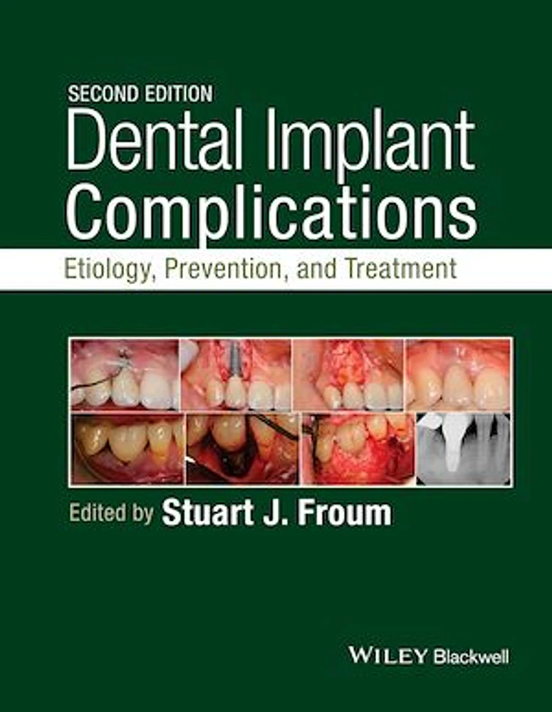 Dental Implant Complications