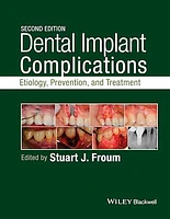 Dental Implant Complications