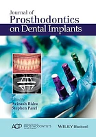 Journal of Prosthodontics on Dental Implants