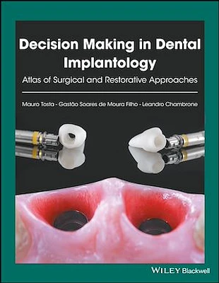 Decision Making in Dental Implantology