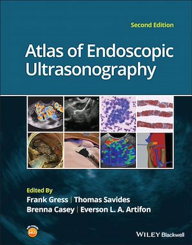 Atlas of Endoscopic Ultrasonography