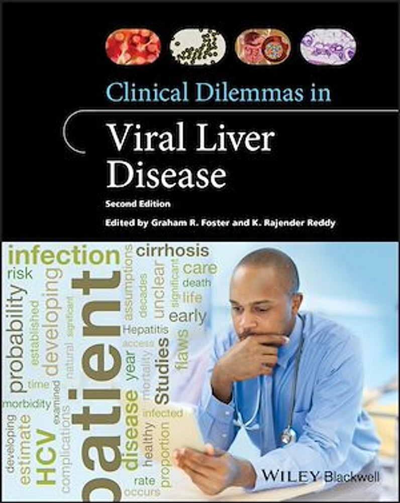 Clinical Dilemmas in Viral Liver Disease