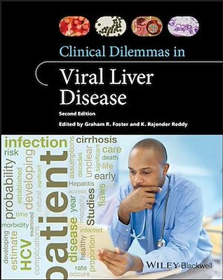 Clinical Dilemmas in Viral Liver Disease