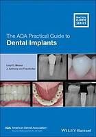 The ADA Practical Guide to Dental Implants