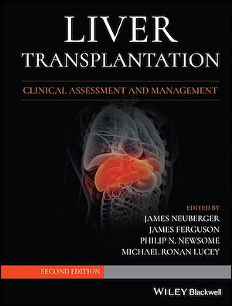 Liver Transplantation