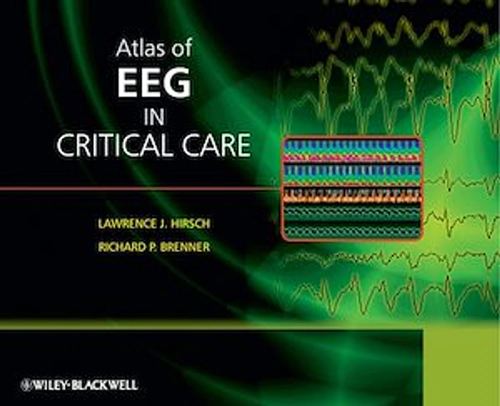 Atlas of EEG in Critical Care