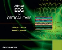 Atlas of EEG in Critical Care