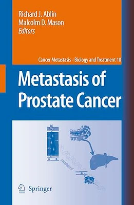 Metastasis of Prostate Cancer