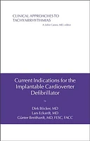 Current Indications for the Implantable Cardioverter Defibrillator