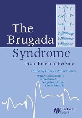 The Brugada Syndrome