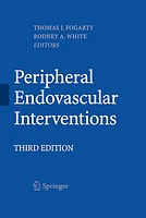 Peripheral Endovascular Interventions