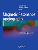 Magnetic Resonance Angiography