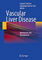 Vascular Liver Disease