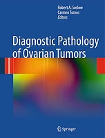 Diagnostic Pathology of Ovarian Tumors